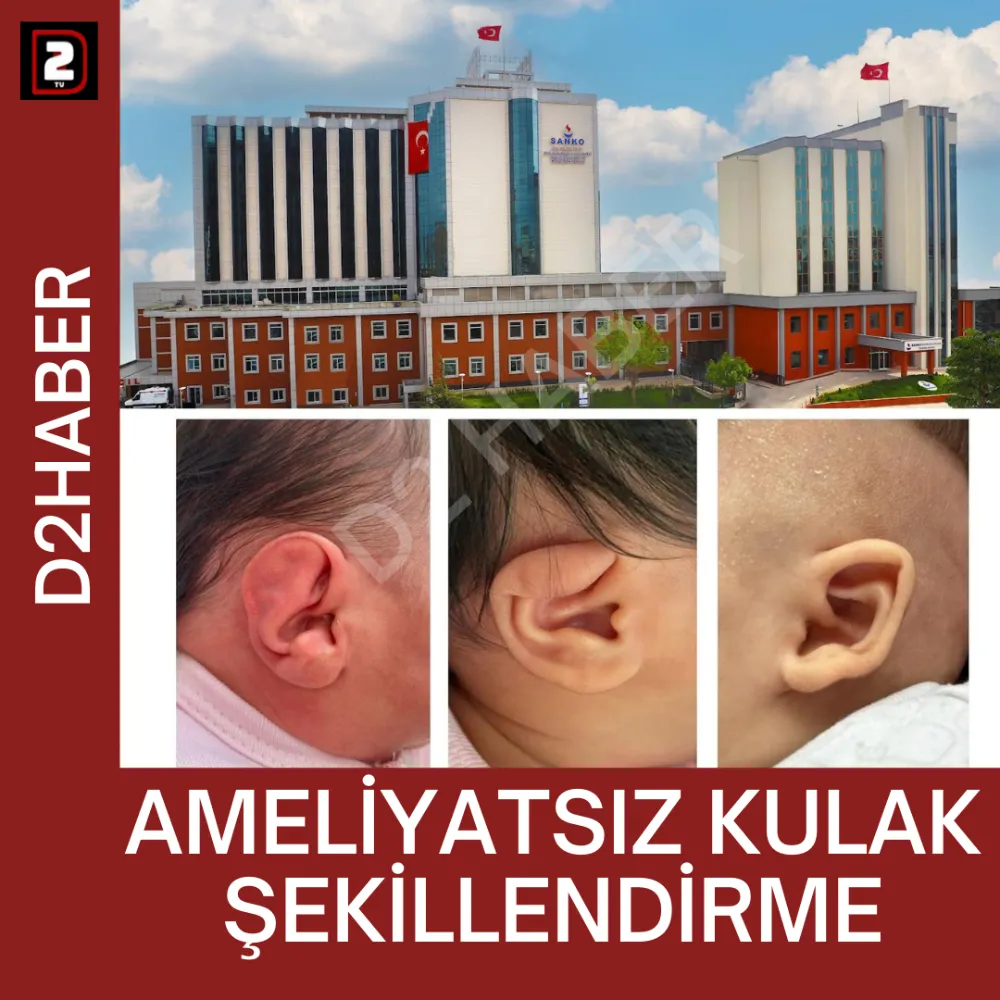 AMELİYATSIZ KULAK ŞEKİLLENDİRME